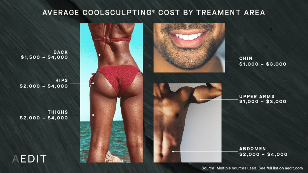 Picture of: How Much Does CoolSculpting® (Cryolipolysis) Cost? (See Prices